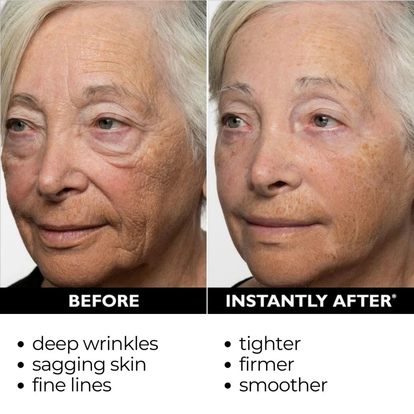 🔥[Official Brand Store] Final 3 Hours: 70% OFF ✨ Lift & Firm Instant Face Tightener